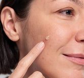 Sole e macchie sulla pelle: 5 consigli per prevenirle e curarle