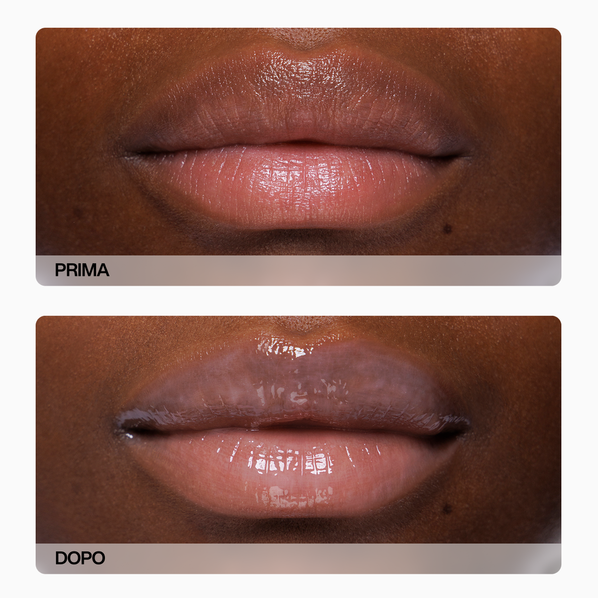 Prima_dopo_2_Soft_Lips_carousel_pdp