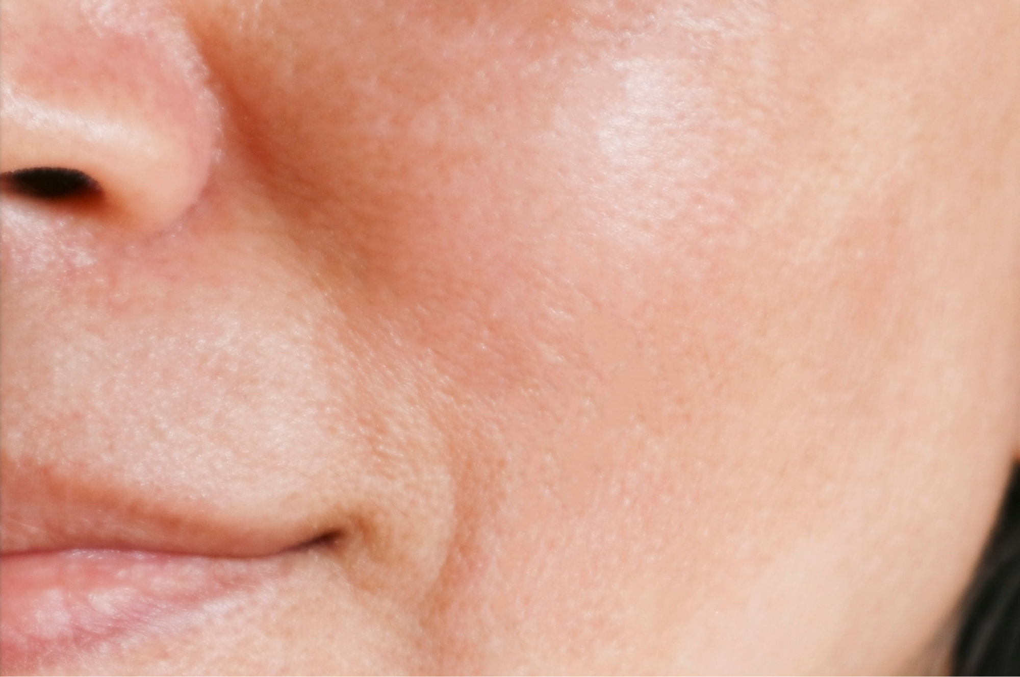 Protocollo Skincare Pelle Normale