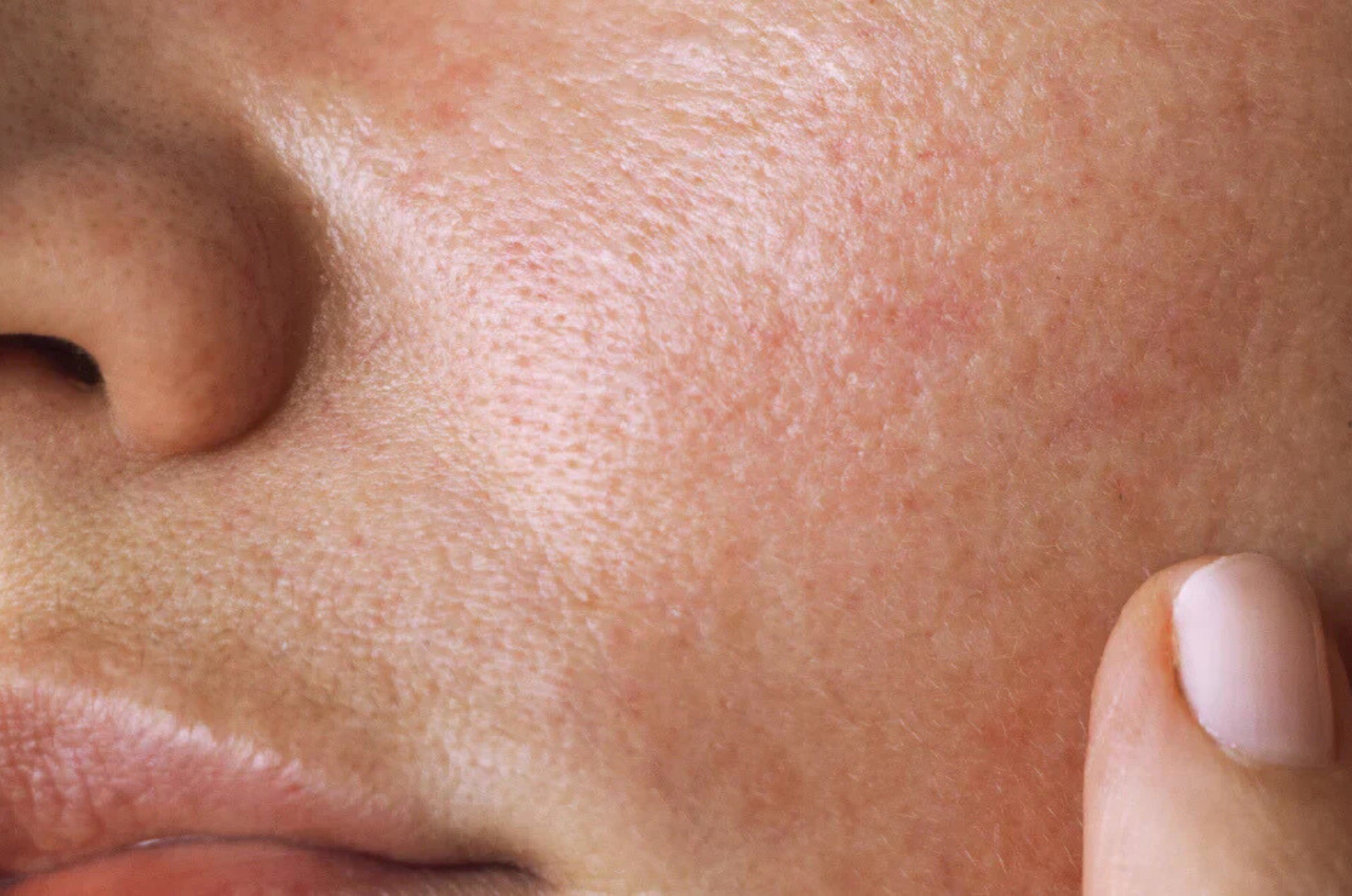 Protocollo Skincare Pelle Mista