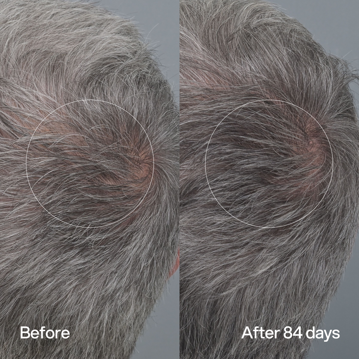 Hair Density Peptide Serum