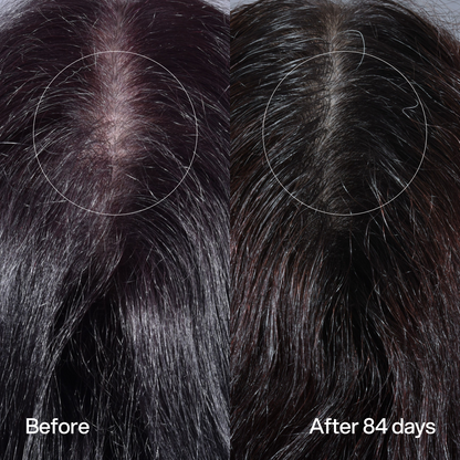 Hair Density Peptide Serum