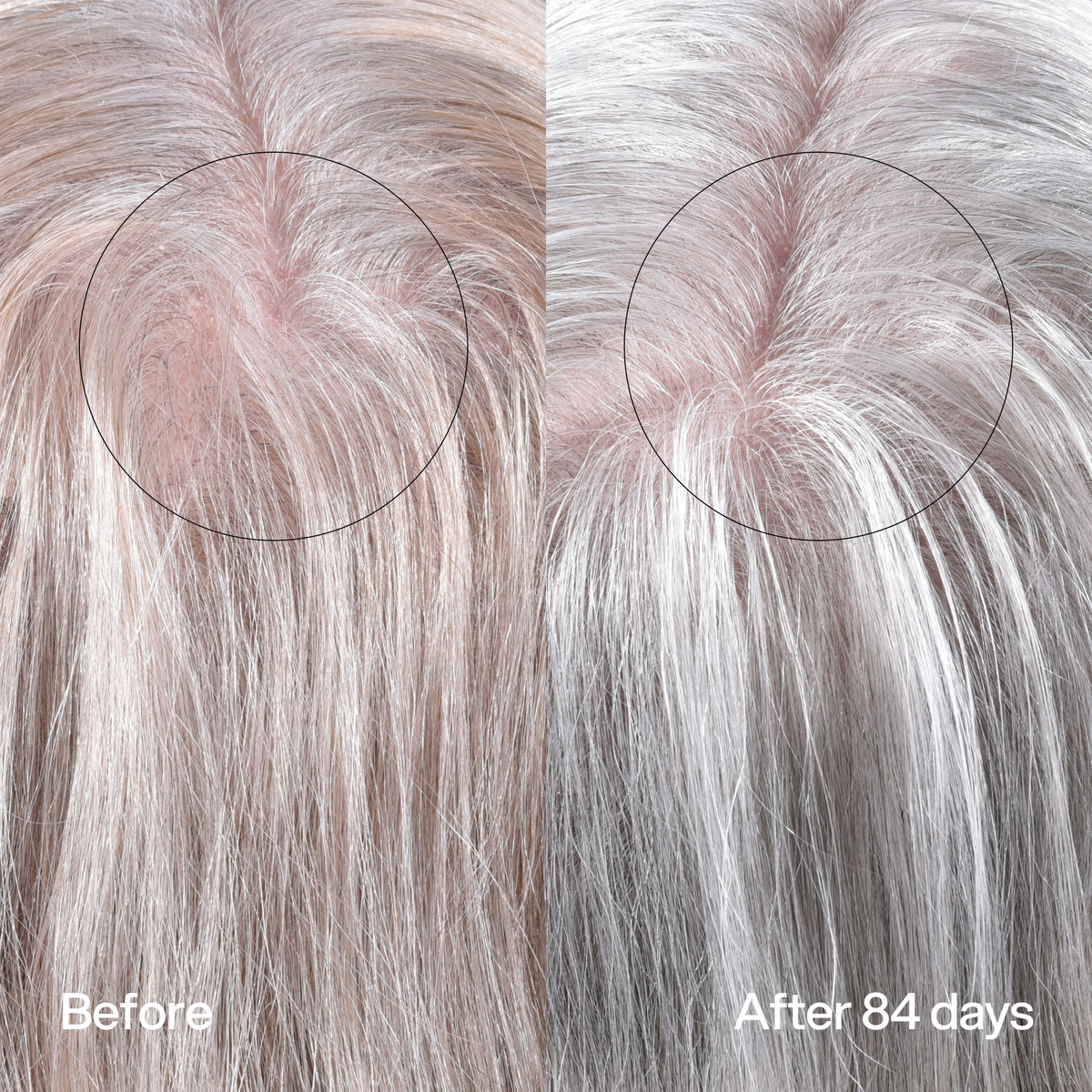 Hair Density Peptide Serum