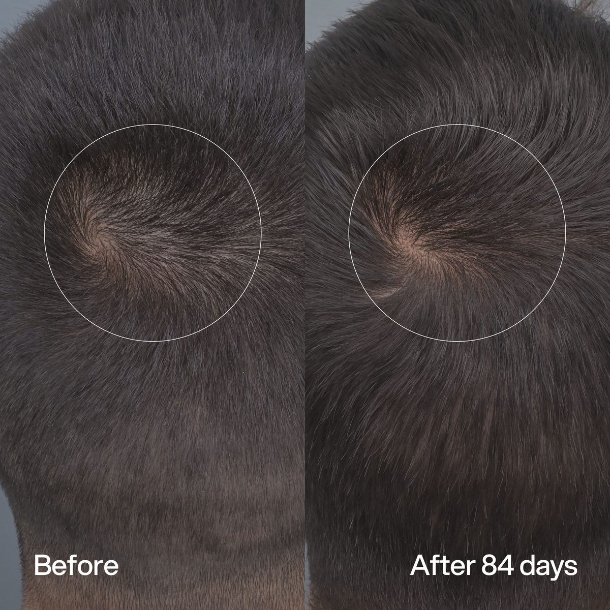 Hair Density Peptide Serum