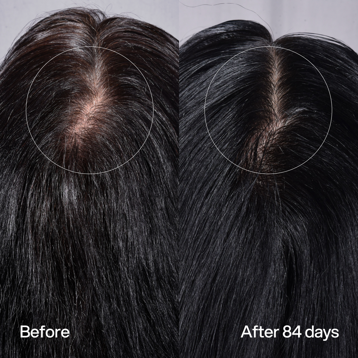 Hair Density Peptide Serum