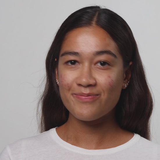 Video Tutorial Applicazione Prodotto: Booster Niacinamide + Azeloglicina